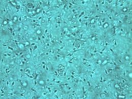 Микроскопическая картина нормальной спермы